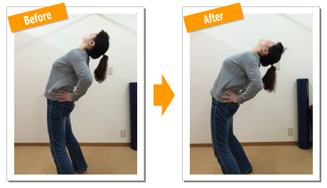 後屈BeforeAfter