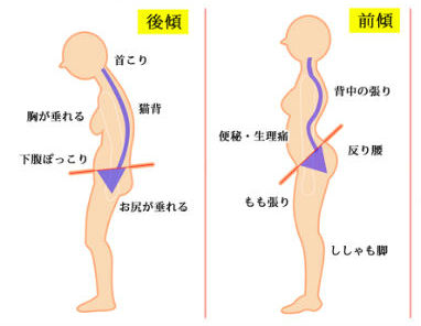 腰痛を寝方で改善させる!睡眠の質を上げる4つの方法