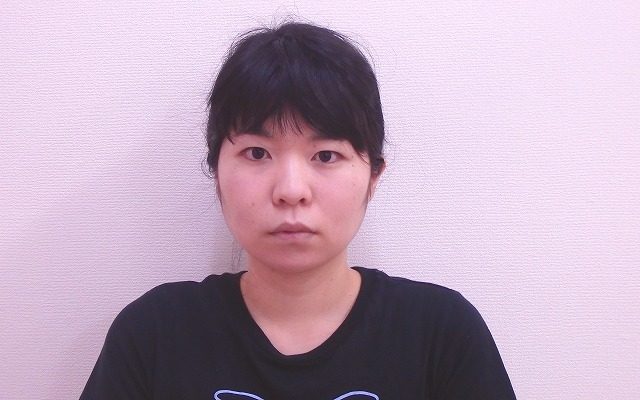 小顔矯正の効果をモニタリング!左右のアンバランス(Iさん20代)Vol.1