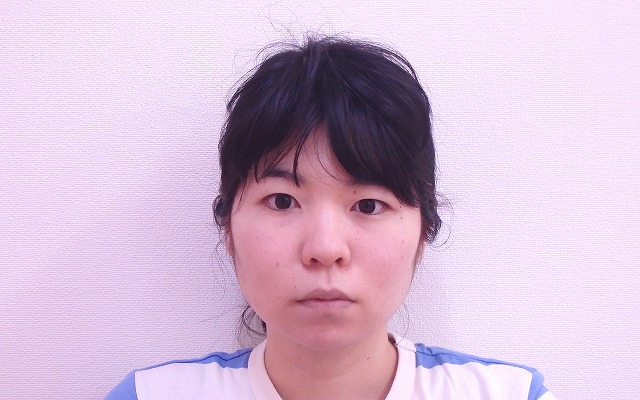 小顔矯正の効果をモニタリング!左右のアンバランス(Iさん20代)Vol.2
