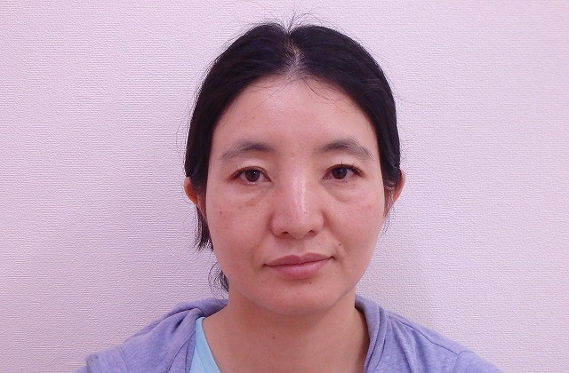 京都で小顔矯正をお探しの方必見!小顔矯正の効果をモニタリング!!Tさん40代 Vol.2