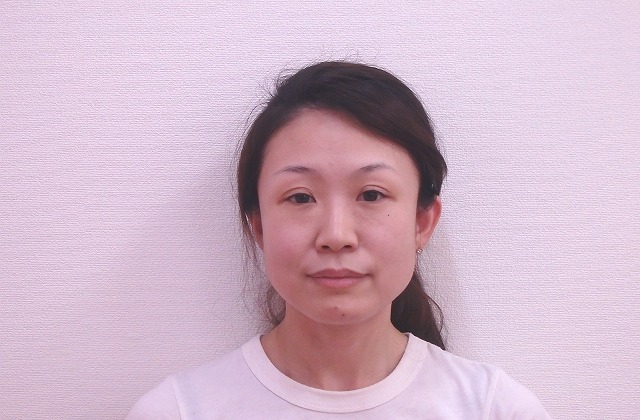 小顔矯正『Before』の様子