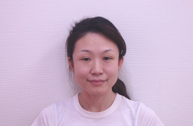小顔矯正『After』の様子
