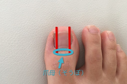 フェノール法