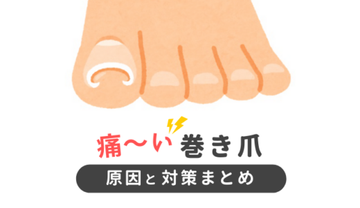痛い巻き爪の治し方と原因を徹底解説！すぐに治したいなら巻き爪ロボがおススメ
