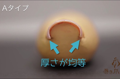 巻き爪ロボAタイプ